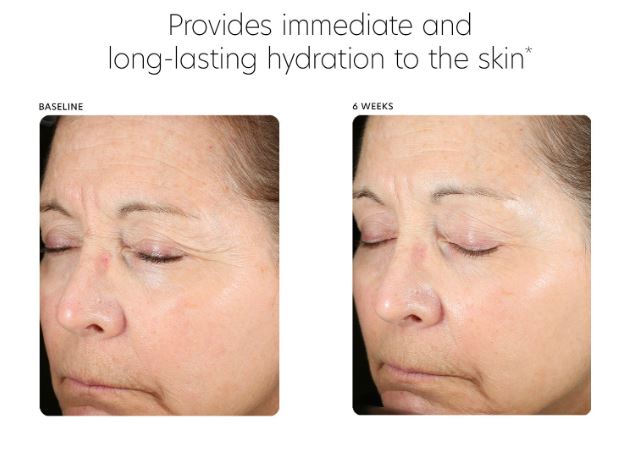 Hyaluronic Acid Boosting Serum