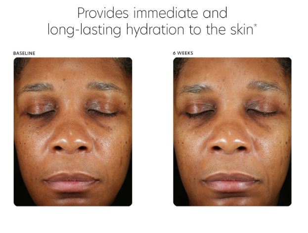 Hyaluronic Acid Boosting Serum